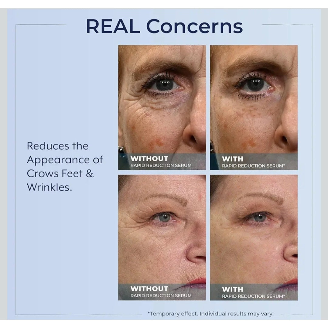 Plexaderm Rapid Reduction Eye Serum