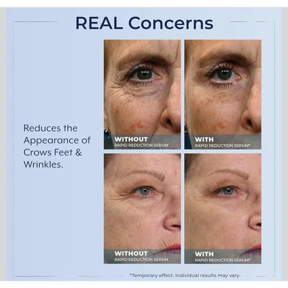 Plexaderm Rapid Reduction Eye Serum