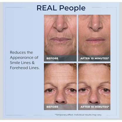 Plexaderm Rapid Reduction Eye Serum