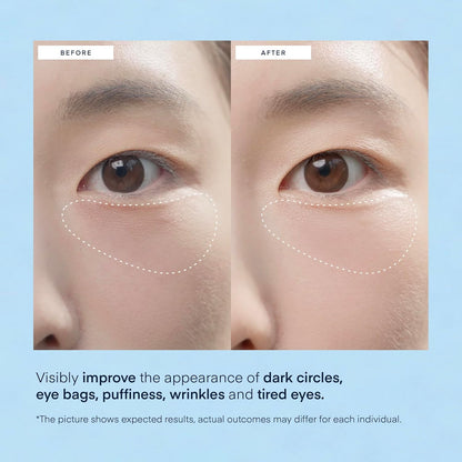 Under Eye Gel Patches w/ Caffeine Hyaluronic Acid Niacinamide Undereye Korea